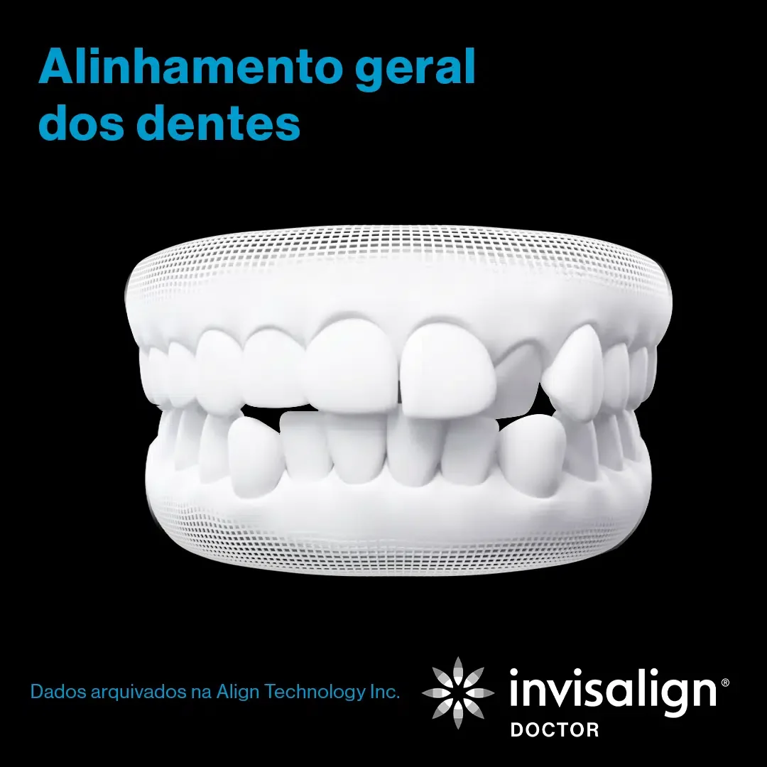 Alinhamento geral dos dentes